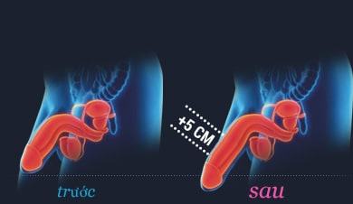 gel maxisize có tốt không