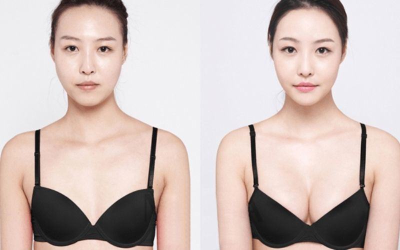 Thuoc-nang-nguc-bust-ultra