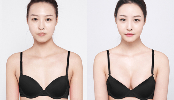 Thuốc nâng ngực Bust Ultra