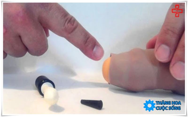 cắt bao quy đầu