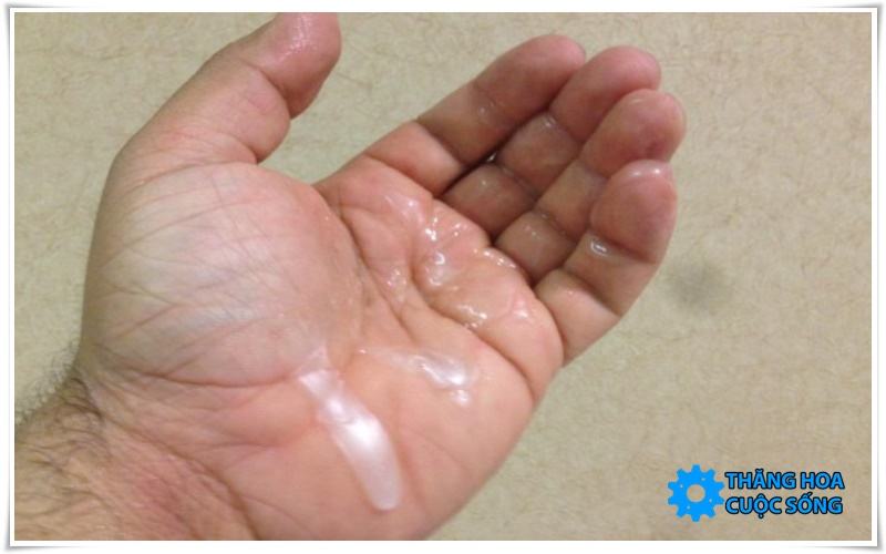 Tinh trùng loãng có mang thai được không