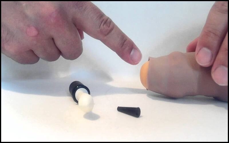 có nên cắt bao quy đầu không