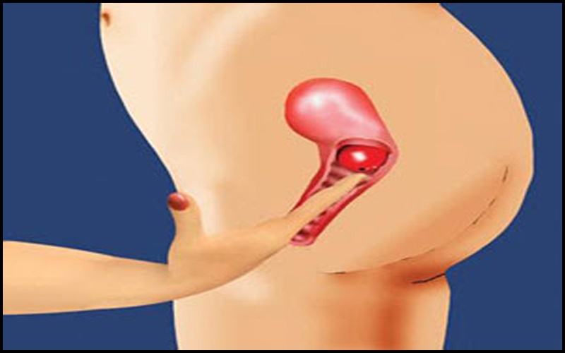 quan hệ chạm vào cổ tử cung