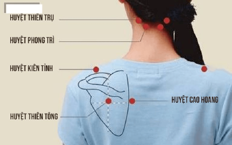 Huyệt thiên trụ – Cổ và sau gáy
