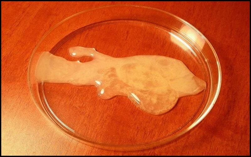 Tinh trùng màu sắc bất thường