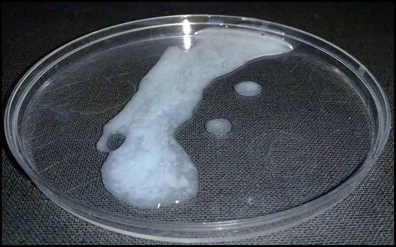 Dấu hiệu tinh trùng yếu