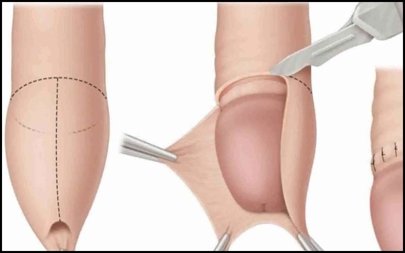 hình dạng của cậu nhỏ