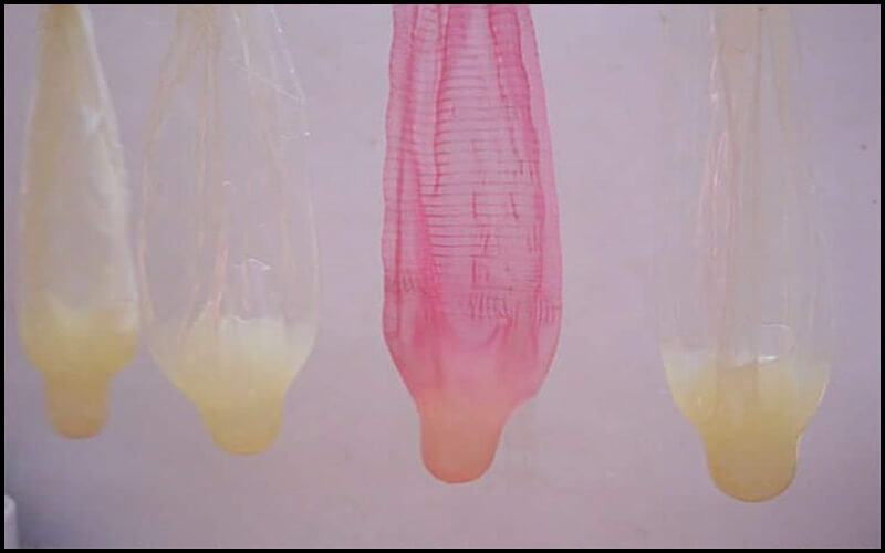 hình ảnh tinh trùng bất thường