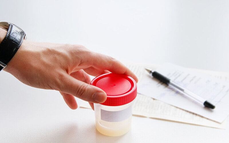 Xét nghiệm tinh dịch đồ