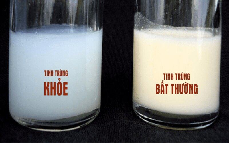 hinh-anh-tinh-trung-binh-thuong