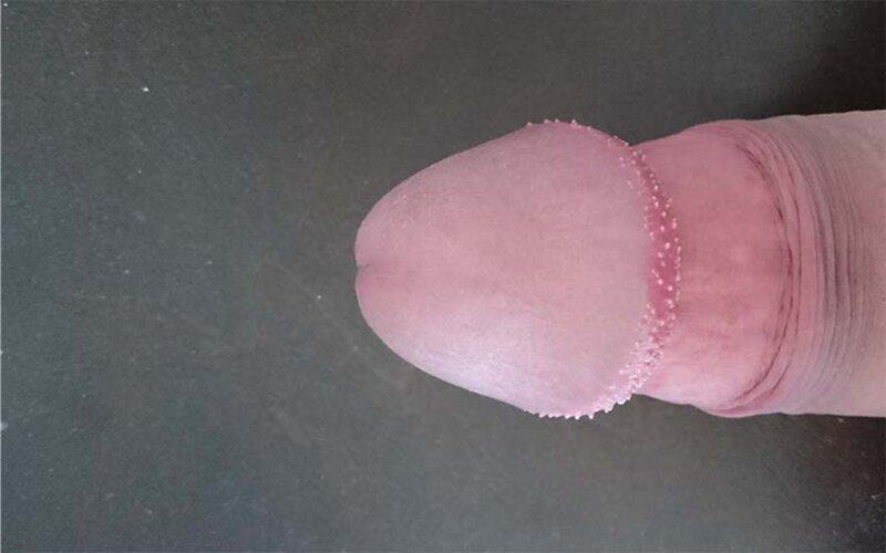 cách chữa chuỗi hạt ngọc dương