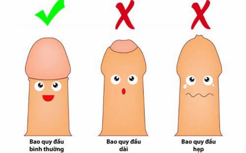 nguyen-nhan-quy-dau-bi-viem