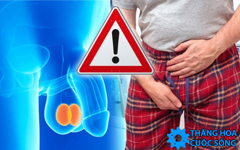 cach-dieu-tri-viem-tinh-hoan