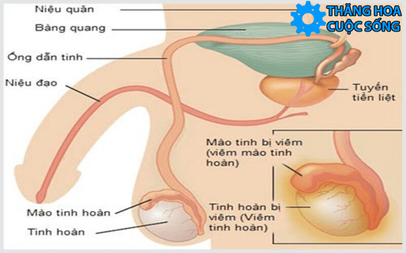 nguyen-nhan-viem-tinh-hoan