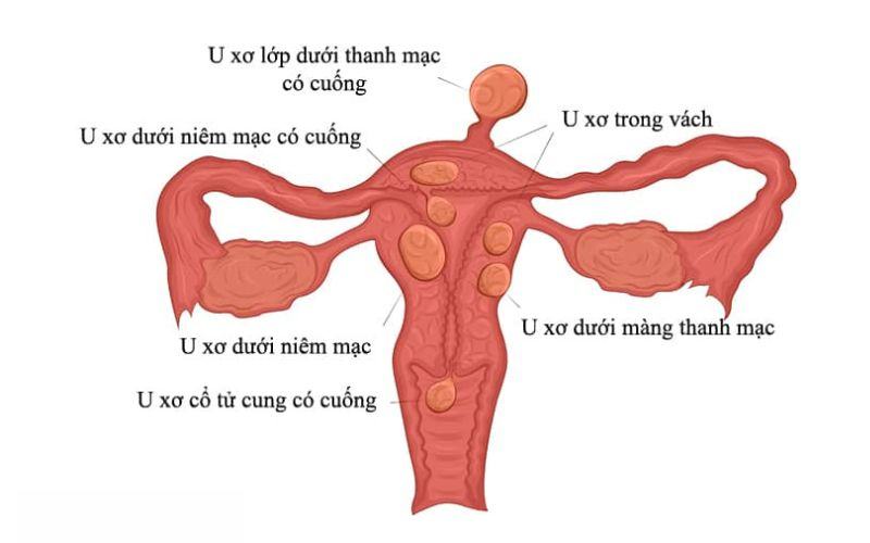 nguyên nhân khi quan hệ ra ít nước