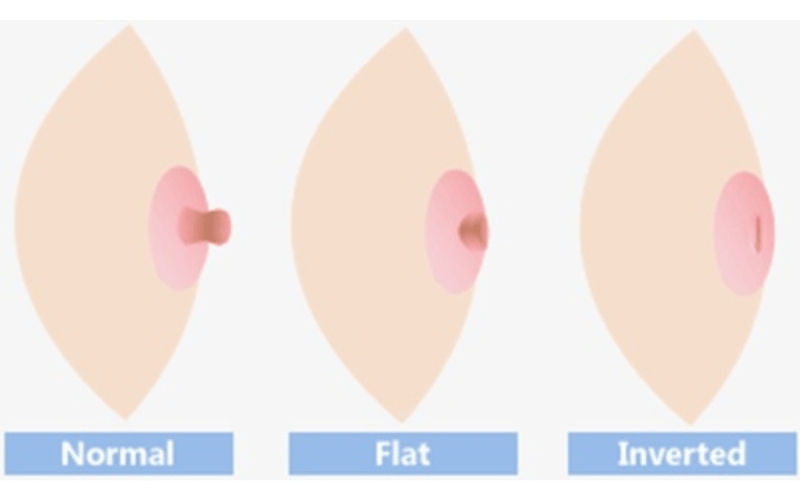 hinh-anh-nhu-hoa-binh-thuong