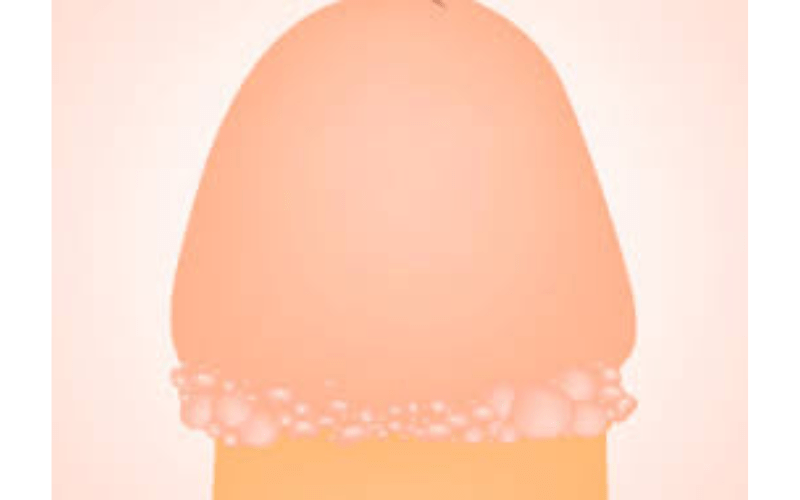 noi-mun-trang-o-bao-quy-dau