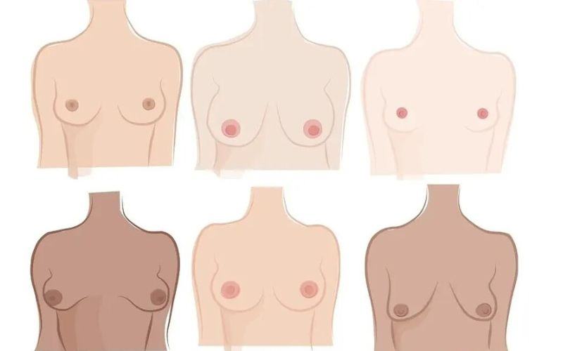 Hình ảnh nhũ hoa bình thường