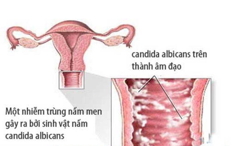 Nguyên nhân chất nhờn của có mùi hôi