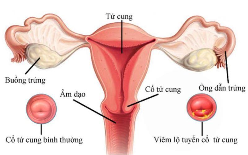 Chất nhờn có mùi hôi