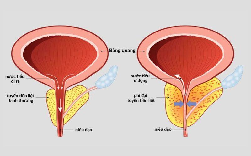 Ảnh hưởng khi nhịn yêu lâu